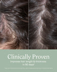 Rizos Curls Complete Lengthening & Thickening Bundle