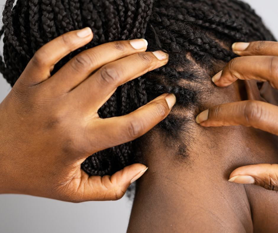 Scalp Health: The Root of Healthy Curls