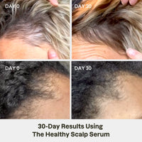 Love Ur Curls Healthy Scalp Serum