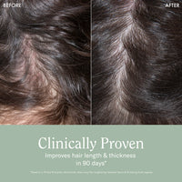 Rizos Curls Complete Lengthening & Thickening Bundle